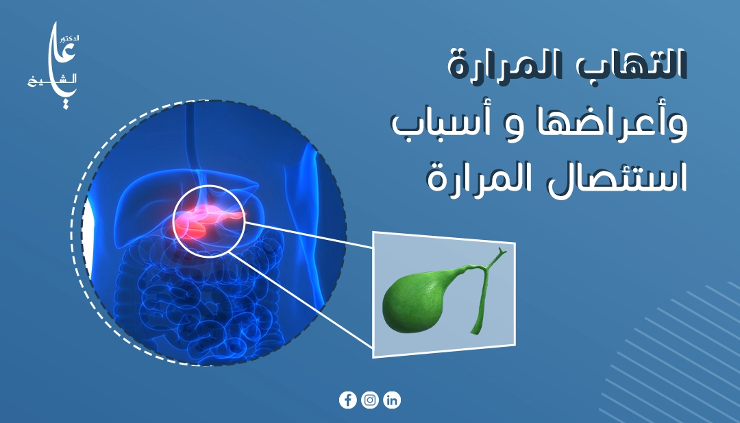 التهاب المرارة واعراضها و اسباب استئصال المرارة