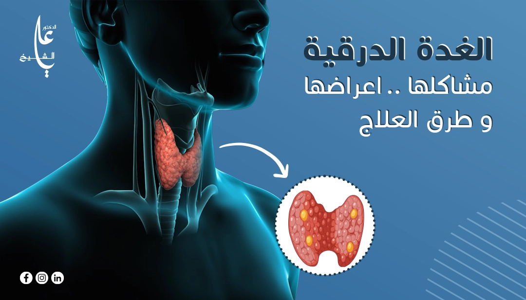 وظائف الغدة الدرقية وما هي اعراض الغدة وعلاجها وما علاقة الغدة الدرقية بالسمنة