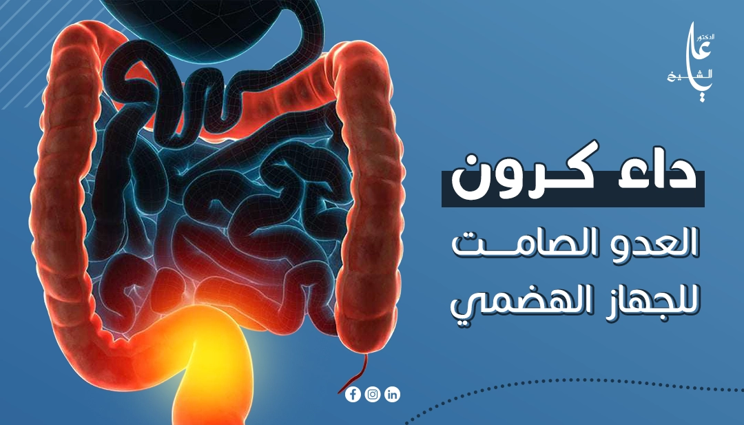 دليل شامل حول داء كرون من الاعراض والأسباب حتى طرق التشخيص والعلاج