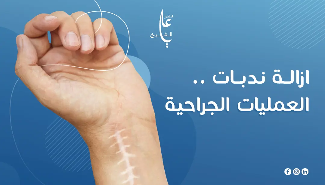 الندبات الجراحية والتجميل: كيفية التخلص من ندبات العمليات الجراحية ؟